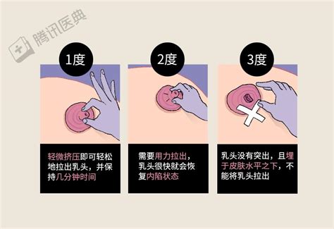 乳晕凸起|乳晕长小疙瘩正常吗？乳头这5种变化，真的不用担心